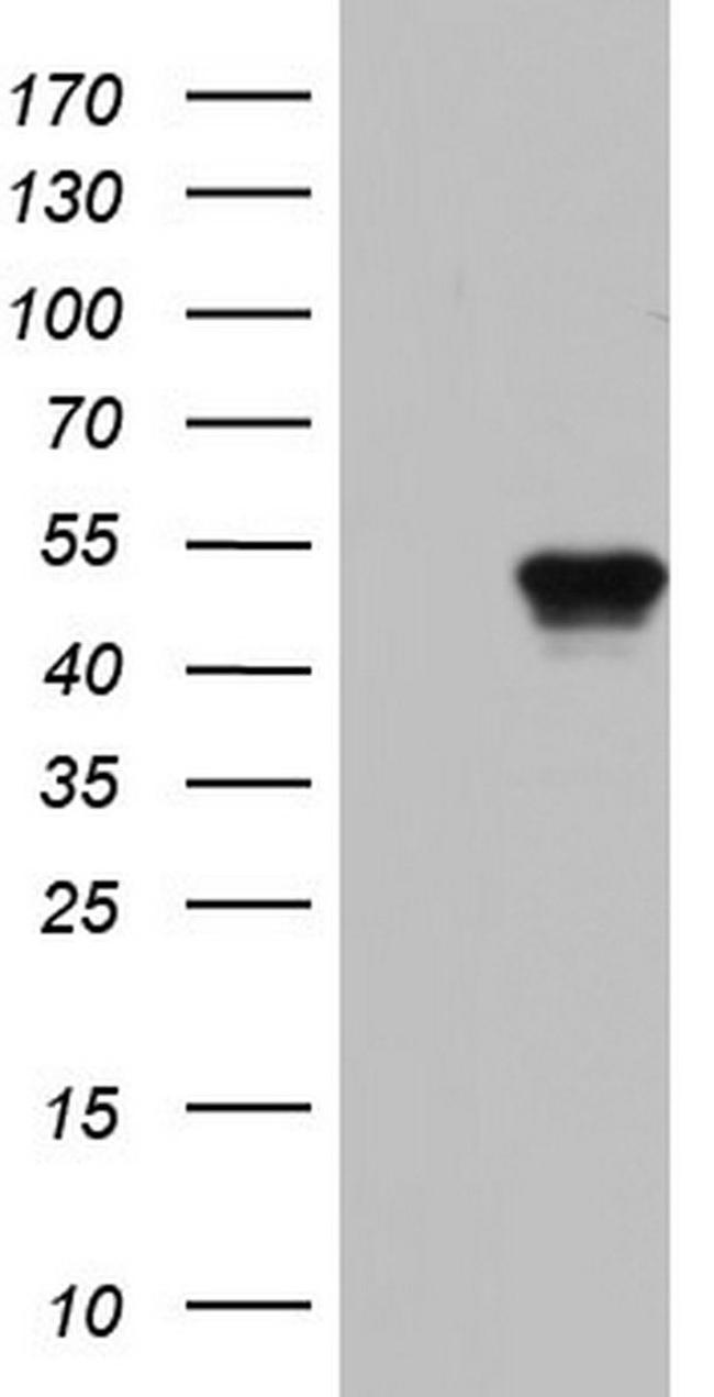 BFSP2 Antibody in Western Blot (WB)