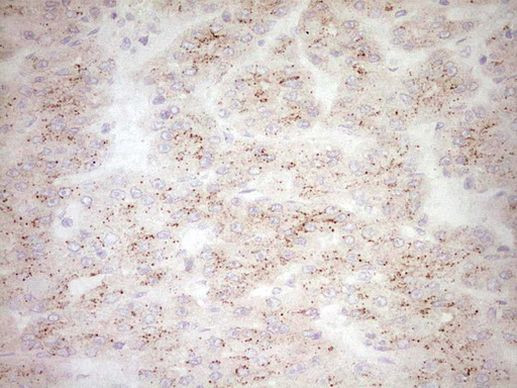 BHLHE41 Antibody in Immunohistochemistry (Paraffin) (IHC (P))