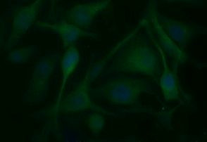 BID Antibody in Immunocytochemistry (ICC/IF)