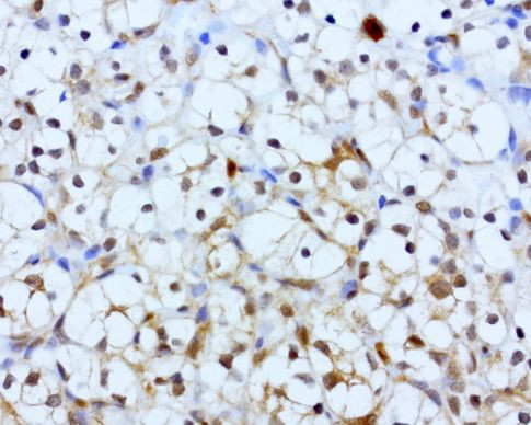 BID Antibody in Immunohistochemistry (Paraffin) (IHC (P))