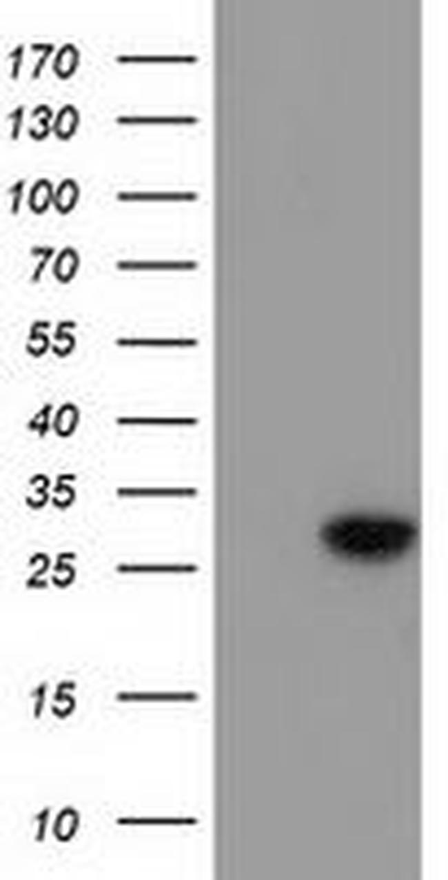 BIN3 Antibody in Western Blot (WB)