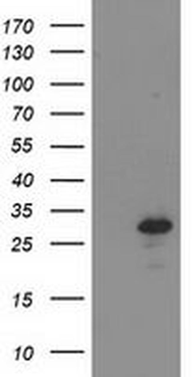 BIN3 Antibody in Western Blot (WB)