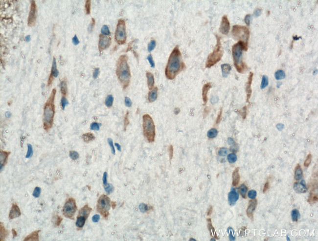 PKM1 Antibody in Immunohistochemistry (Paraffin) (IHC (P))