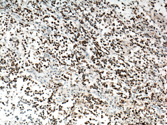 PCNA Antibody in Immunohistochemistry (Paraffin) (IHC (P))