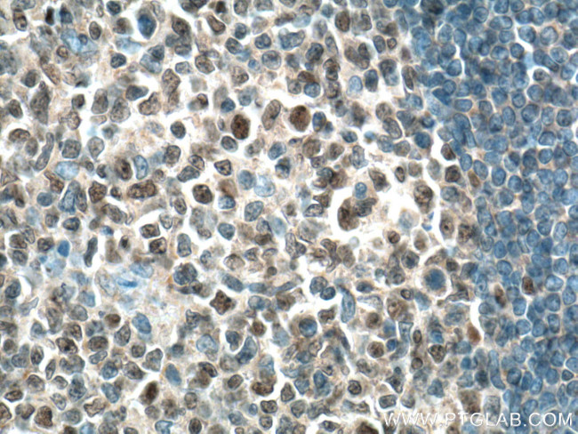 BCL6 Antibody in Immunohistochemistry (Paraffin) (IHC (P))