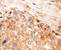 Livin Antibody in Immunohistochemistry (IHC)