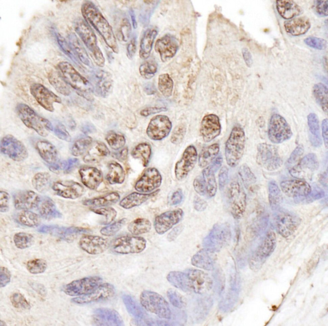 BLAP75 Antibody in Immunohistochemistry (IHC)