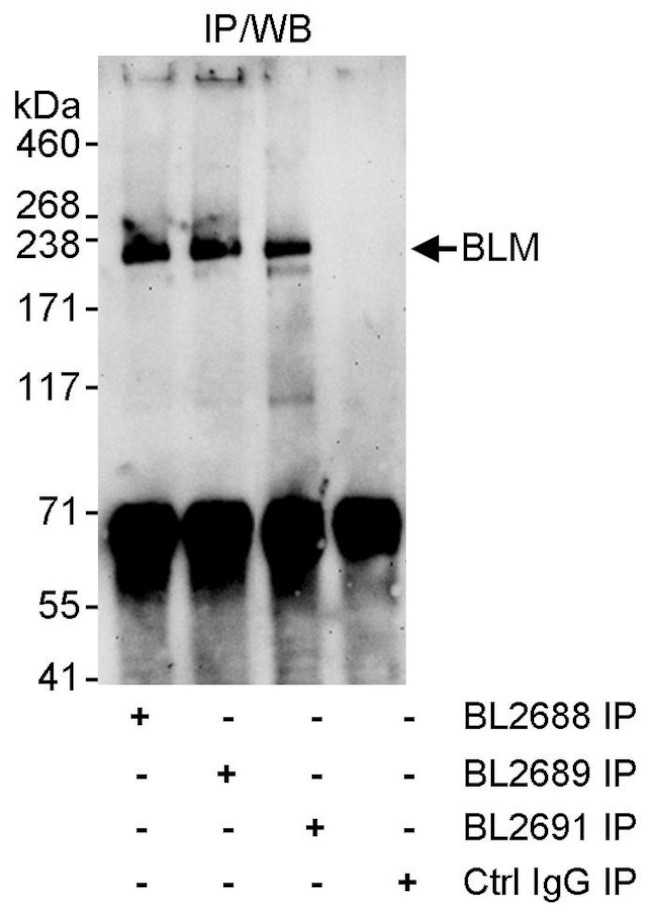 BLM Antibody in Immunoprecipitation (IP)