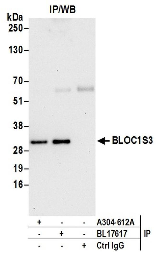 BLOC1S3 Antibody in Western Blot (WB)