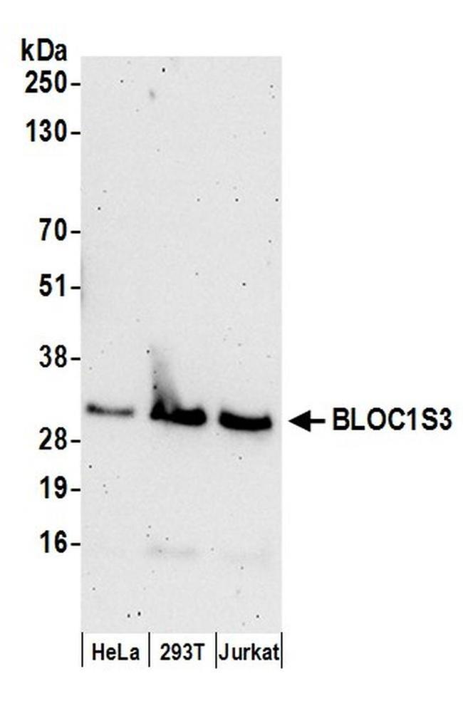 BLOC1S3 Antibody in Western Blot (WB)