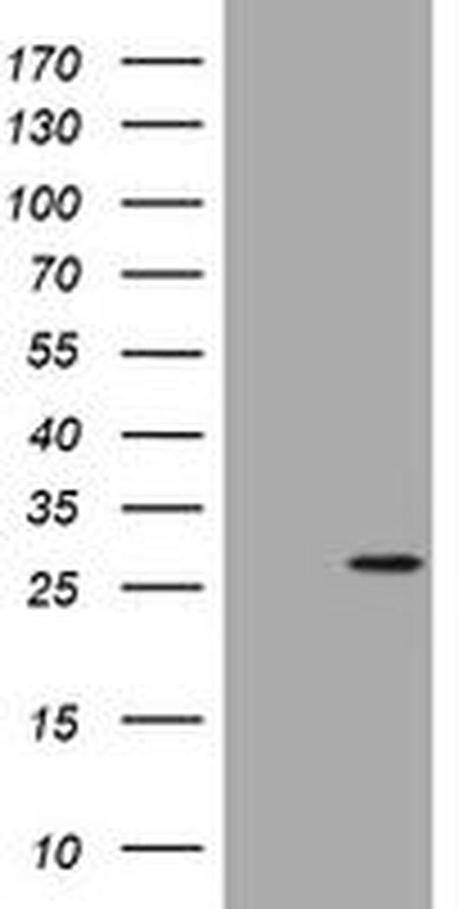 BNIP1 Antibody in Western Blot (WB)