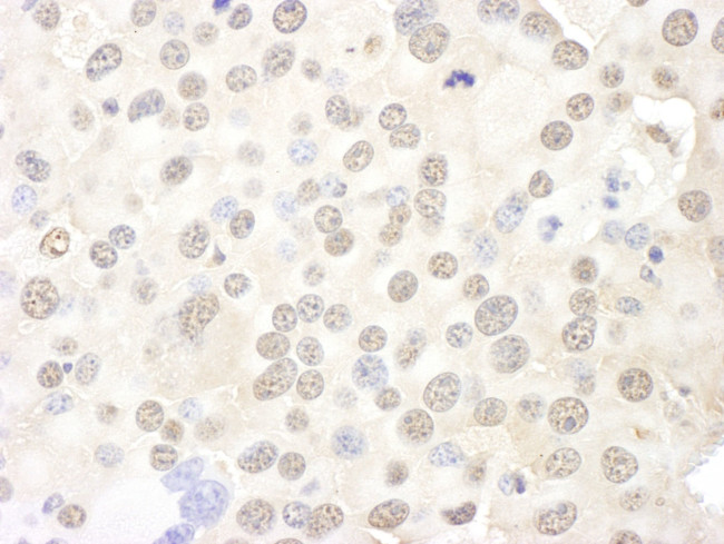 BOP1 Antibody in Immunohistochemistry (IHC)