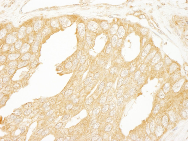 BRAF Antibody in Immunohistochemistry (IHC)