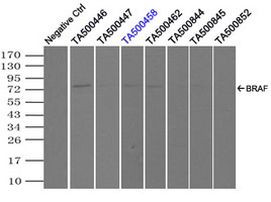 BRAF Antibody in Immunoprecipitation (IP)