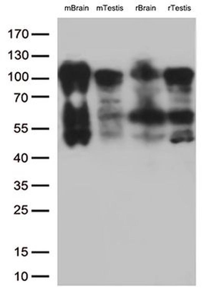 BRAF Antibody in Western Blot (WB)