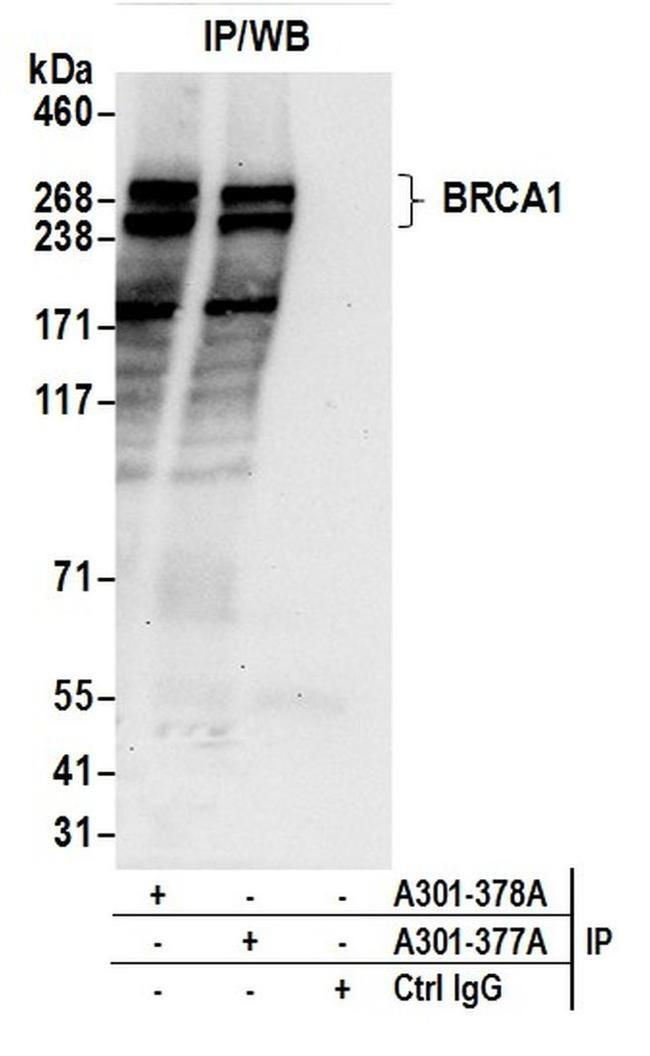 BRCA1 Antibody in Western Blot (WB)