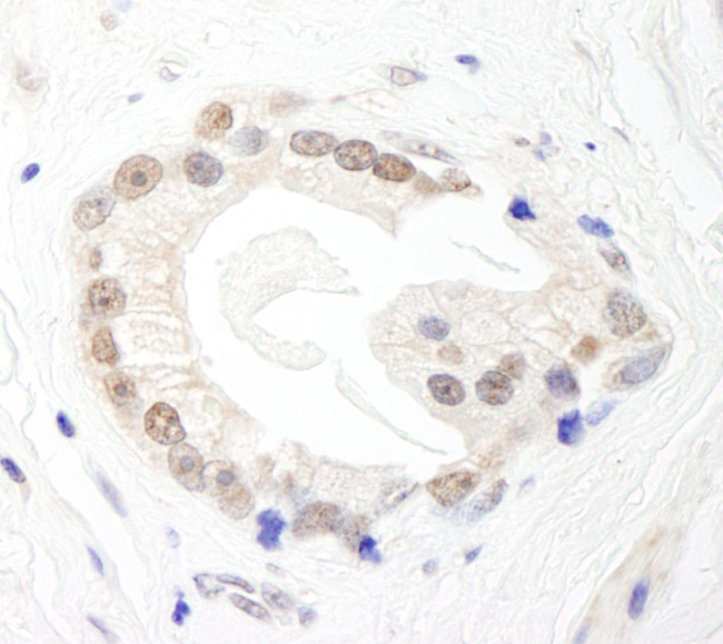 BRF1 Antibody in Immunohistochemistry (IHC)