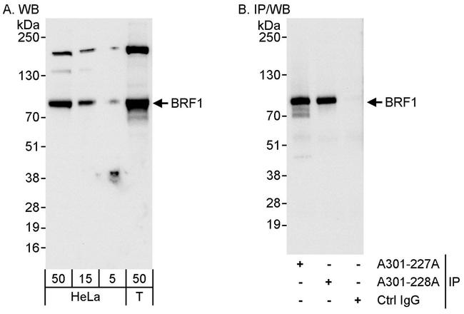 BRF1 Antibody in Western Blot (WB)