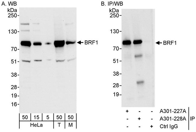 BRF1 Antibody in Western Blot (WB)