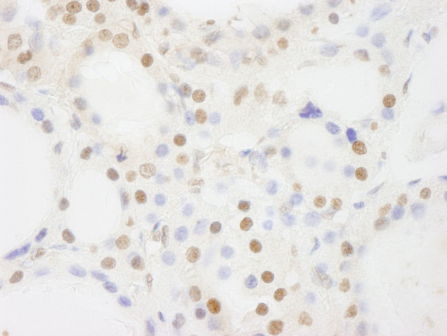 BRF1 Antibody in Immunohistochemistry (IHC)