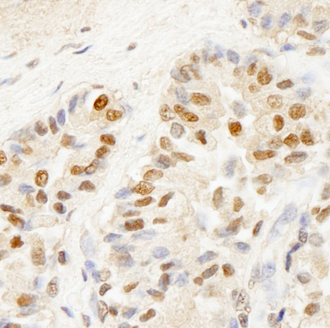 BRF1 Antibody in Immunohistochemistry (IHC)