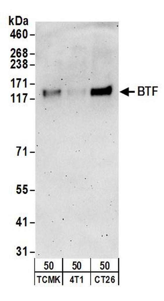 BTF Antibody in Western Blot (WB)