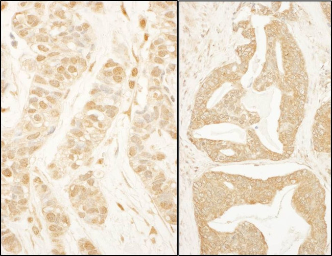 BTF3 Antibody in Immunohistochemistry (IHC)