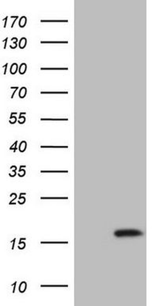 BTG2 Antibody in Western Blot (WB)