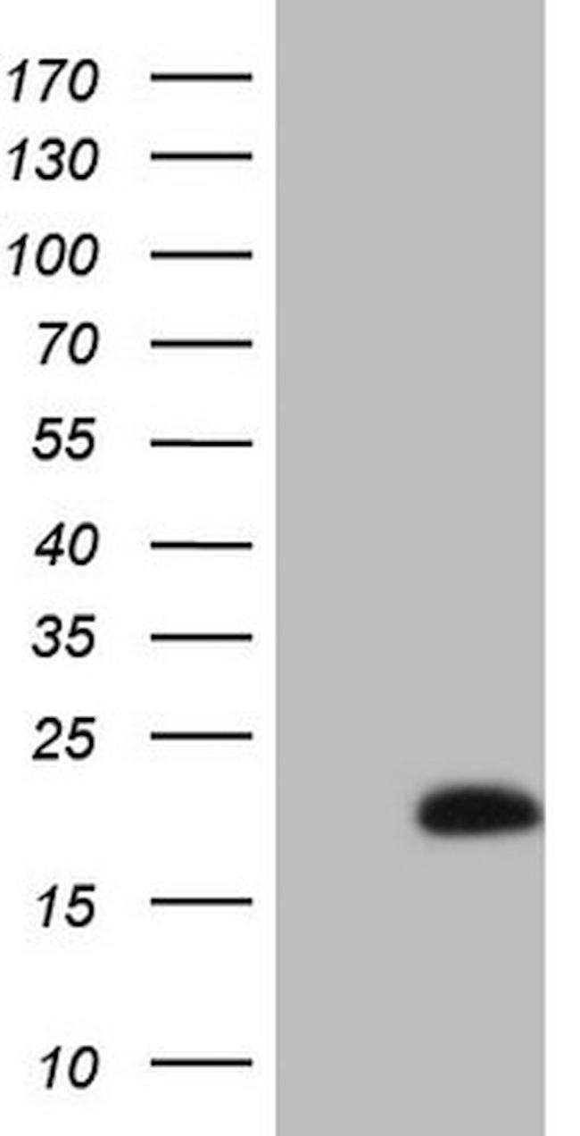 BTG2 Antibody in Western Blot (WB)