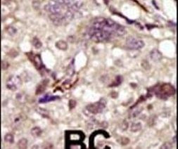 Btk Antibody in Immunohistochemistry (IHC)