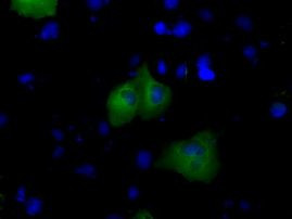 BTK Antibody in Immunocytochemistry (ICC/IF)