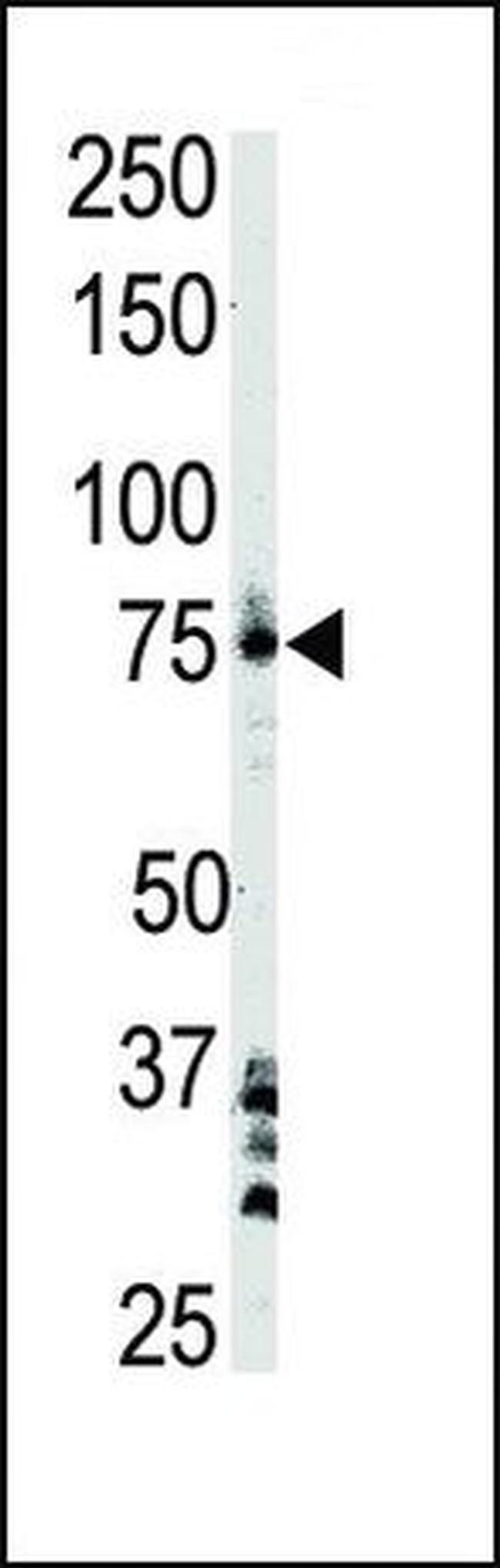 Btk Antibody in Western Blot (WB)