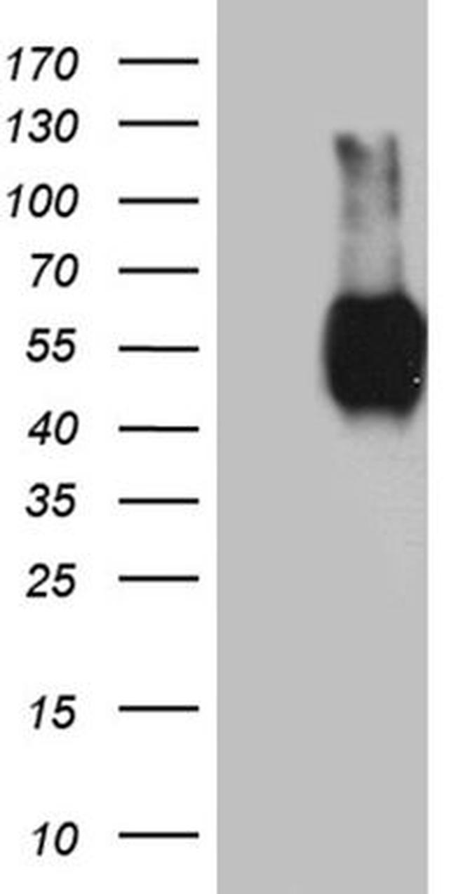 BTLA Antibody in Western Blot (WB)