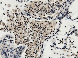 BTN1A1 Antibody in Immunohistochemistry (Paraffin) (IHC (P))