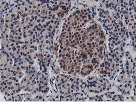 BTN1A1 Antibody in Immunohistochemistry (Paraffin) (IHC (P))