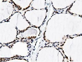 BTN1A1 Antibody in Immunohistochemistry (Paraffin) (IHC (P))