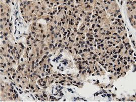 BTN1A1 Antibody in Immunohistochemistry (Paraffin) (IHC (P))