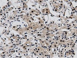 BTN1A1 Antibody in Immunohistochemistry (Paraffin) (IHC (P))