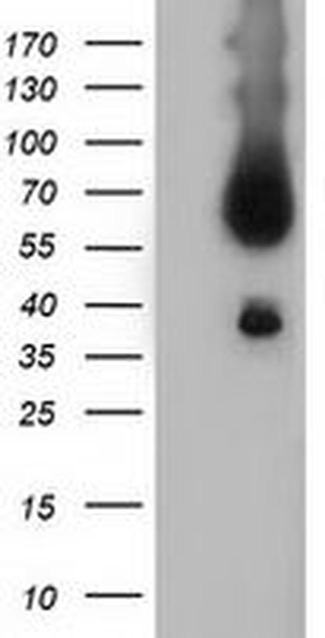 BTN1A1 Antibody in Western Blot (WB)