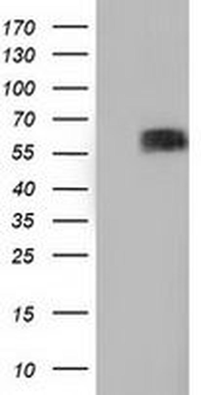 BTN1A1 Antibody in Western Blot (WB)