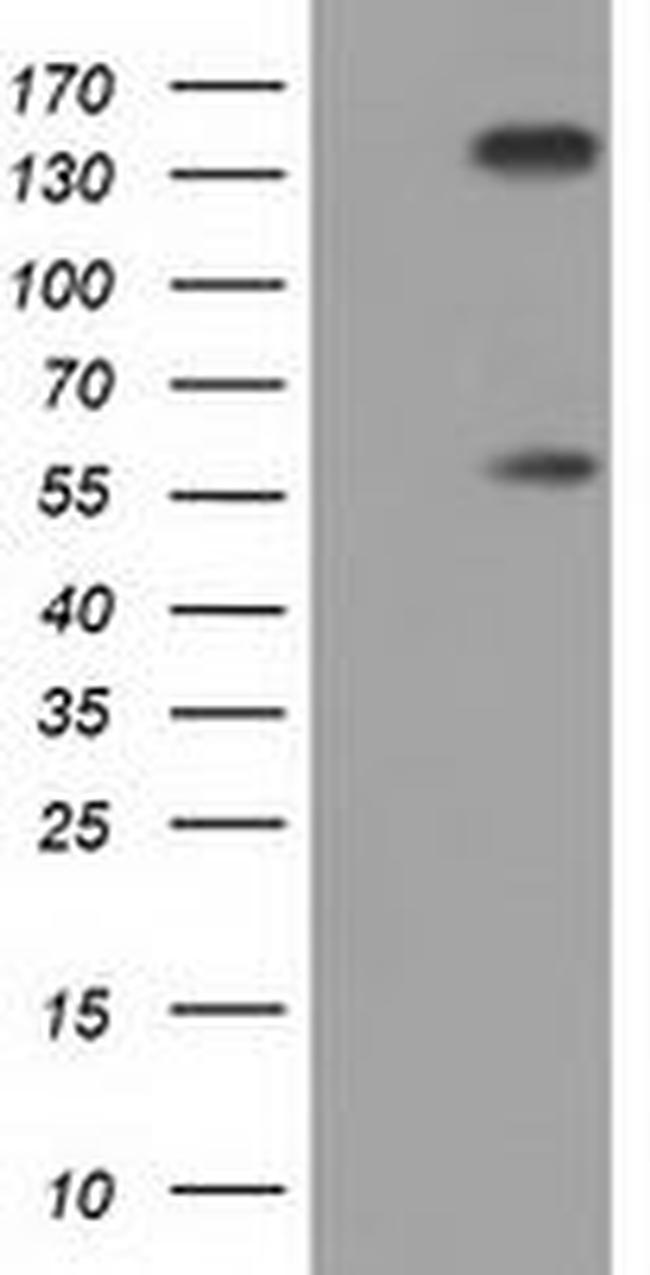 BTN1A1 Antibody in Western Blot (WB)