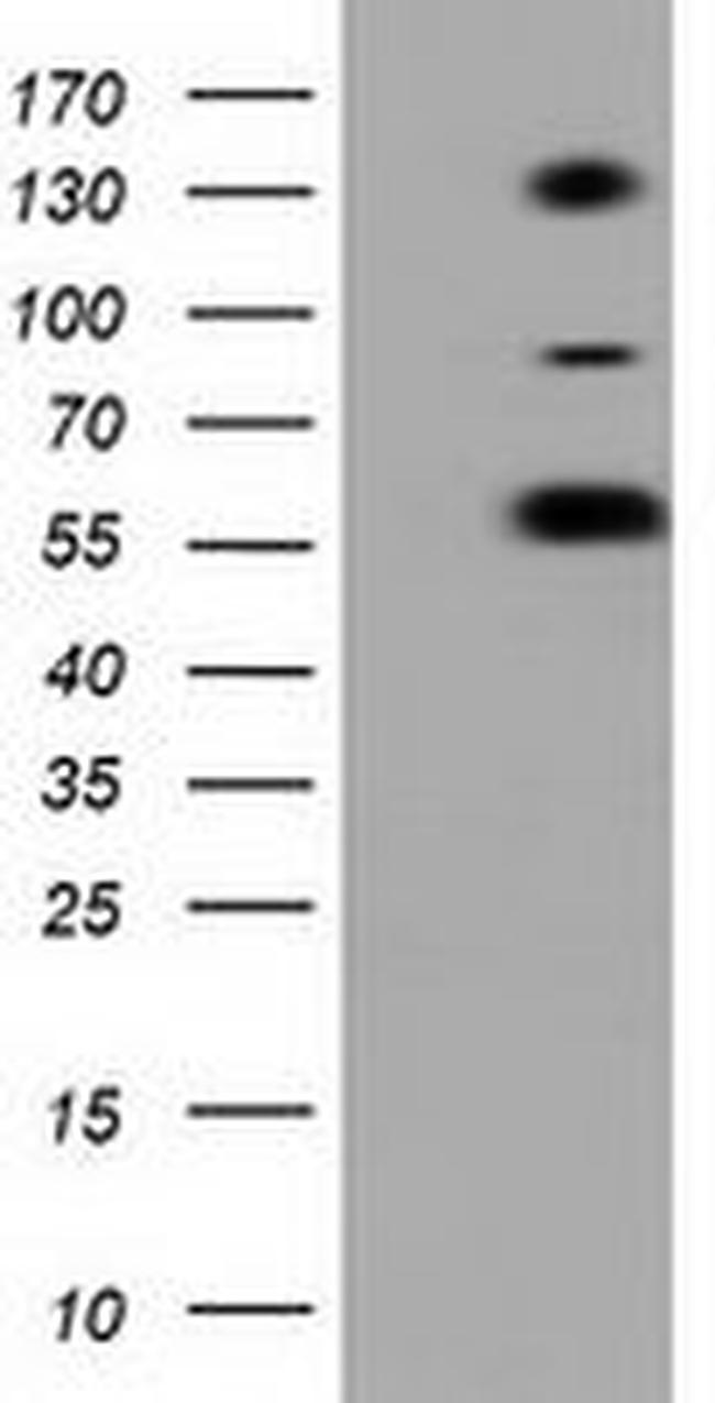 BTN1A1 Antibody in Western Blot (WB)