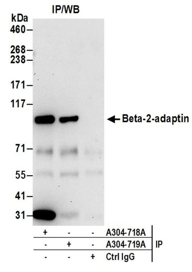 Beta-2-adaptin Antibody in Western Blot (WB)