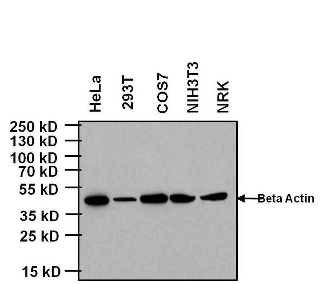 KLRB1 Antibody in Western Blot (WB)