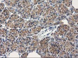 Beta-catenin Antibody in Immunohistochemistry (Paraffin) (IHC (P))