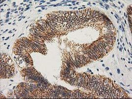 Beta-catenin Antibody in Immunohistochemistry (Paraffin) (IHC (P))