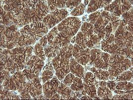 Beta-catenin Antibody in Immunohistochemistry (Paraffin) (IHC (P))