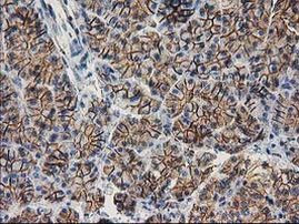 Beta-catenin Antibody in Immunohistochemistry (Paraffin) (IHC (P))