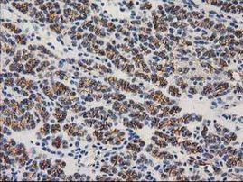 Beta-catenin Antibody in Immunohistochemistry (Paraffin) (IHC (P))