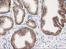 Beta-catenin Antibody in Immunohistochemistry (Paraffin) (IHC (P))